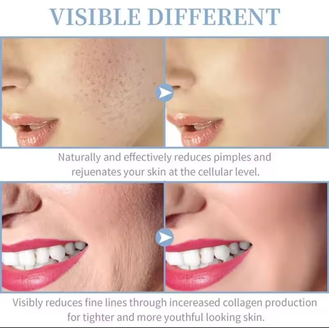 Portable High Frequency Machine Wand